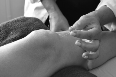 Acupuncture on the knee